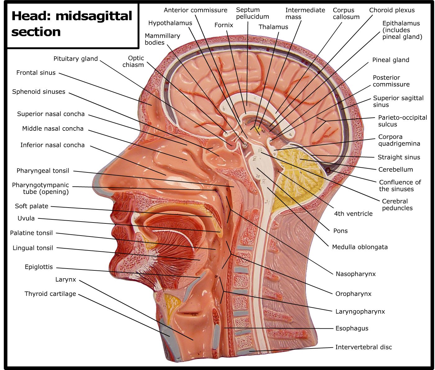 brain midsagittal view